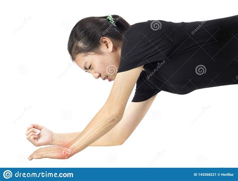 Wrist Bones Injury Stock Image Image Of Cramp Osteoporosis 145268221