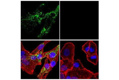 Fibronectinfn1 E5h6x Rabbit Mab Alexa Fluor® 488 Conjugate Cell