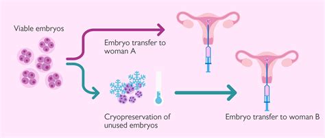 Donating surplus IVF embryos to other couples