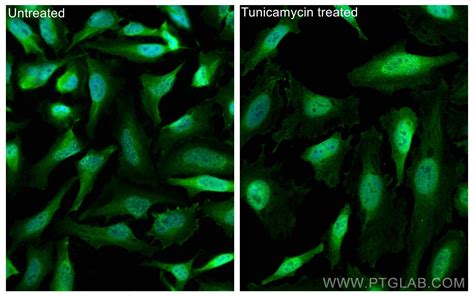 Atf4 Antibody 10835 1 Ap Proteintech