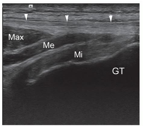 Adult Hip Radiology Key