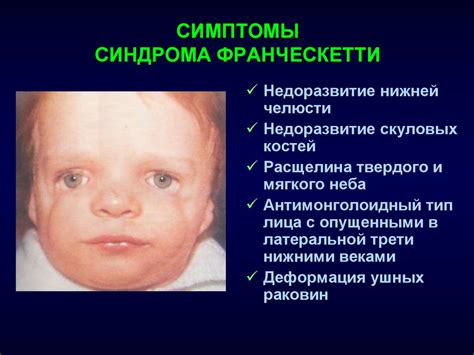 Врожденные синдромы. Врожденные кисты и свищи шеи. Дермоидные кисты ...