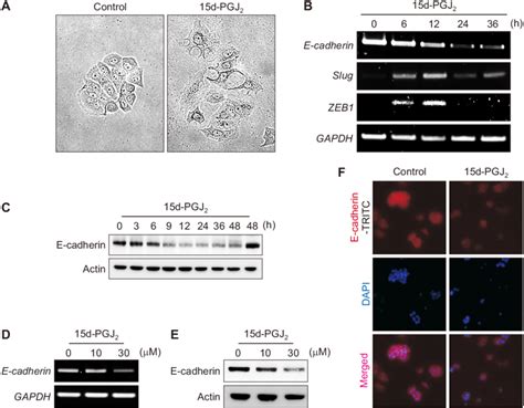 15d Pgj 2 Induced Emt Of Phenotypes Mcf 7 Cells A Mcf 7 Cells Were Download Scientific