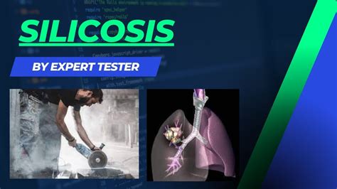 Silicosis Pneumoconiosis Causes Symptoms Diagnosis Treatment