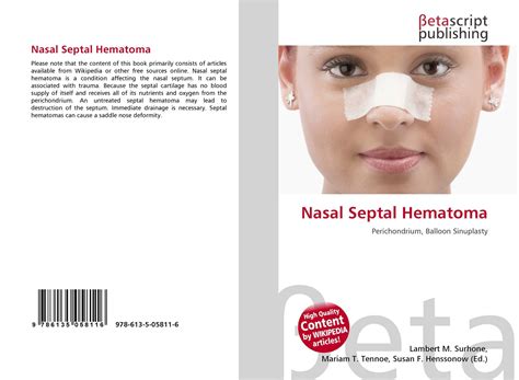 Nasal Septal Hematoma, 978-613-5-05811-6, 6135058118 ,9786135058116