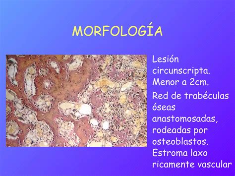 Patología Osteoarticular PPT