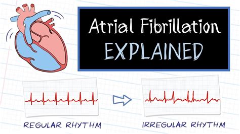 What Is Atrial Fibrillation Youtube