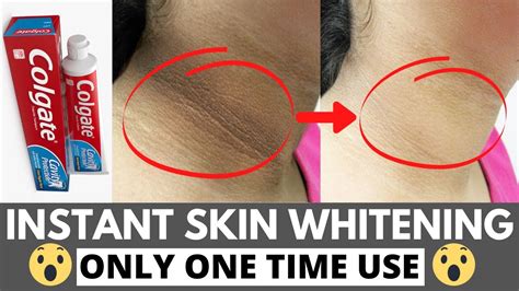 Instant Skin Whitening With Colgate Home Remedy Amazing Uses Of