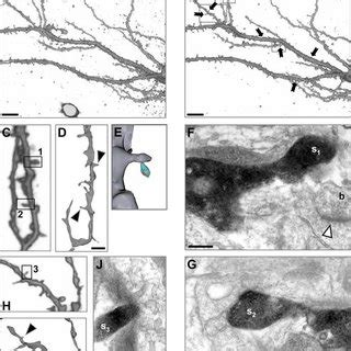 Most Preexisting Spines Are Part Of Ultrastructurally Mature Synapses