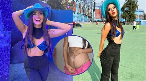 Cicatriz De Tammy Parra La Tiktoker Que Est En Tendencia En Redes