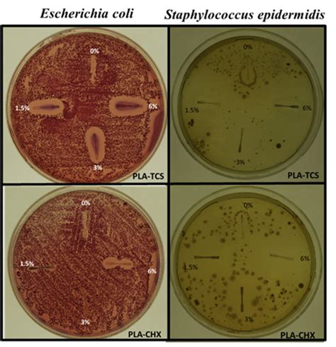 Staphylococcus Epidermidis Left And Escherichia Coli Right