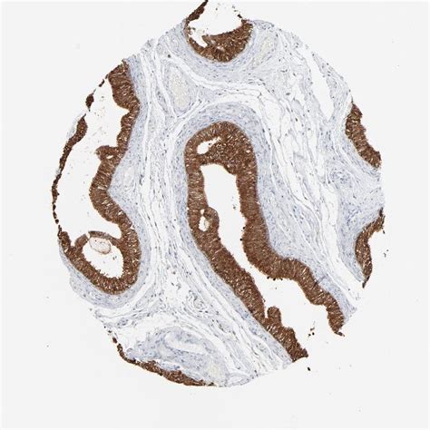 Tissue Expression Of Phgdh Staining In Epididymis The Human Protein