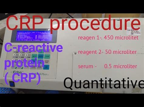 Crp Test Biochemistry Erba Chem 5 V2 Plus CRP Test In Hindi YouTube