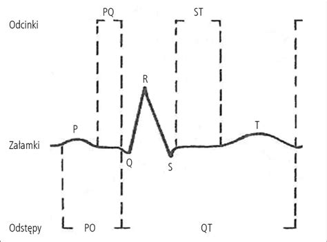 Pediatria Po Dyplomie Prawid Owy Zapis Ekg U Dzieci Od Noworodka Do