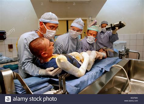 Third Degree Burn Skin Stock Photos And Third Degree Burn Skin Stock