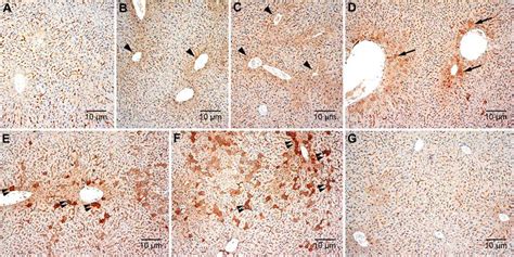 SciELO Brasil Hepatic Inducible Nitric Oxide Synthase Expression