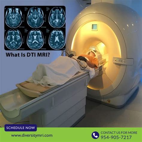 What Is DTI MRI? Why Would I Need It? – Diversity MRI Diagnostic Center ...