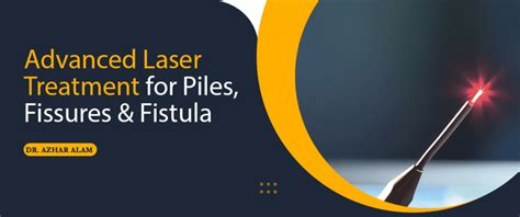 Advanced Laser Treatment For Piles Fissures And Fistula