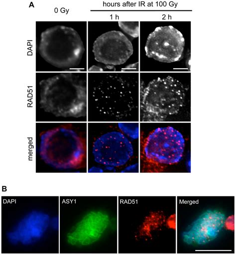 Rad Foci Are Formed In Root Tip Nuclei And Pmcs Of Rad Rad Gfp