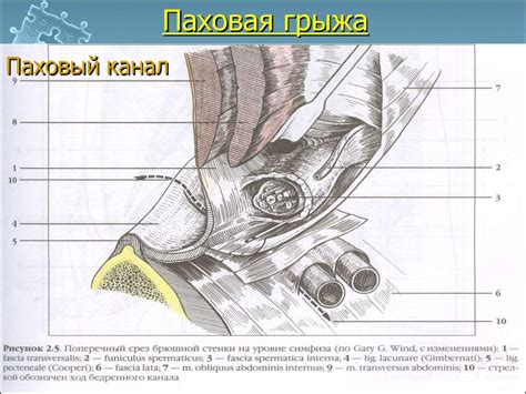 Наружные брюшные грыжи - online presentation