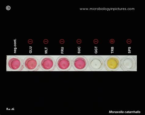 Moraxella Catarrhalis Identification Tests Used For The Identification