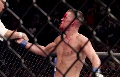 Nate Diaz Joins The Social Media Battle Takes Shot At Khabib Nurmagomedov