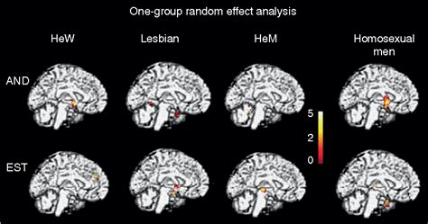 Figure 3 From Sexual Differentiation Of The Human Brain In Relation To Gender Identity And