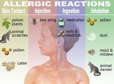 Causes of Allergic Reactions