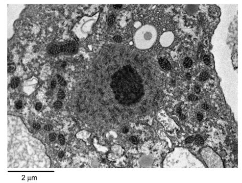 The Transmission Electron Micrograph Of Acanthamoeba Trophozoite M Is Download Scientific