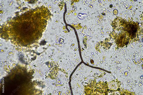 soil microbes organisms in a soil and compost sample, fungus and fungi and under the microscope ...