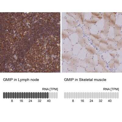 GEM Interacting Protein Antibody NBP2 30537 Novus Biologicals