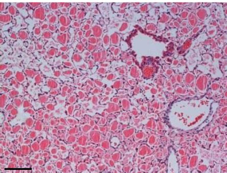 A Murine Model Of Hereditary Pulmonary Alveolar Proteinosis Caused By