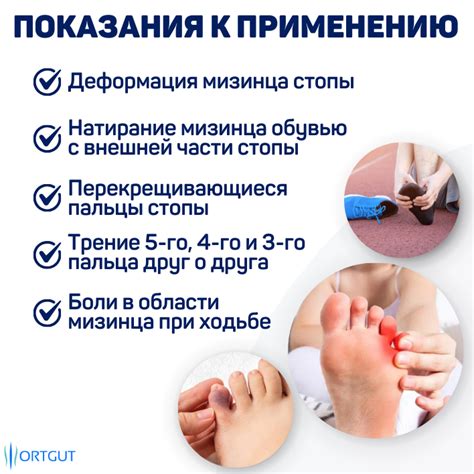 Купить протектор мизинца с фиксацией 3 пальцев в интернет-магазине ...