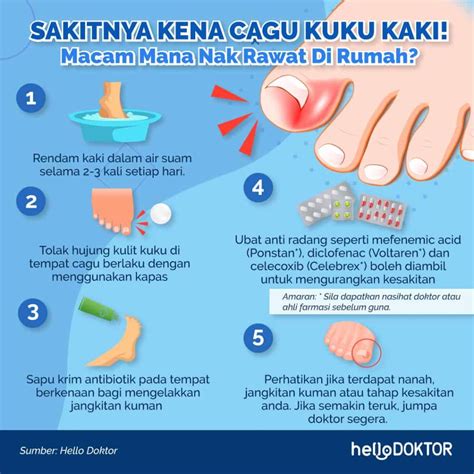 Kuku Kaki Cengkam Ini Punca Sebenarnya Dan Cara Merawat Cagu