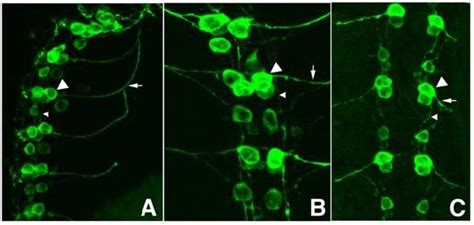 Gfp Abcam