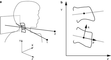 A Roentgen Stereophotogrammetric Analysis RSA Setup And Definition Of