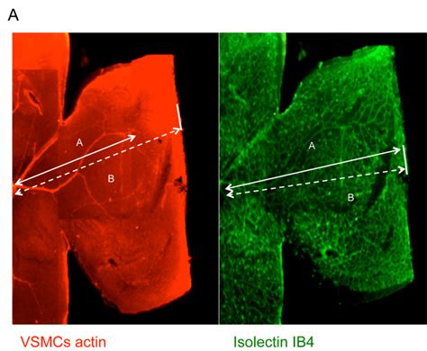 A Typical Result Of Whole Mount Immuno Fluorescence Staining Of The