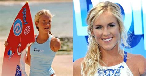 Bethany Hamilton Had Her Arm Bit Off By A Shark But What Is She Up To Today