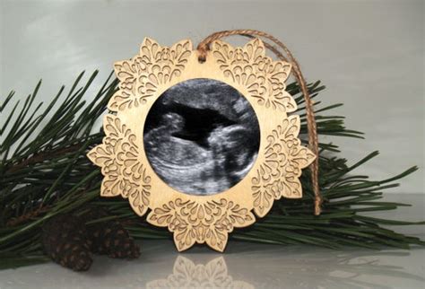 Ultrasound Ornament Sonogram Ornament Pregnancy Ornament - Etsy