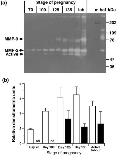 A Representative Gelatin Zymography Gel Of Samples Of Ovine Amniotic