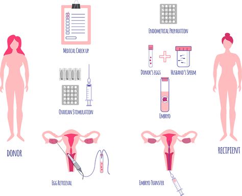 Egg Donation Sperm Donor And Embryo Adoption In Ireland Egg Donor Bank