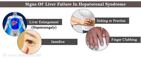 Hepatorenal Syndrome Causes Clinical Features Diagnosis And Treatment