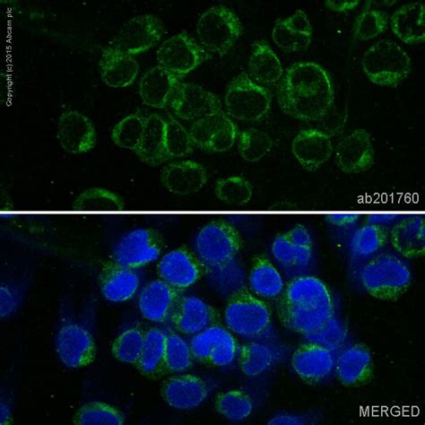 Alexa Fluor 488 Anti Prolactin Receptor PRL R 抗体 EPR7184 2 ab201760