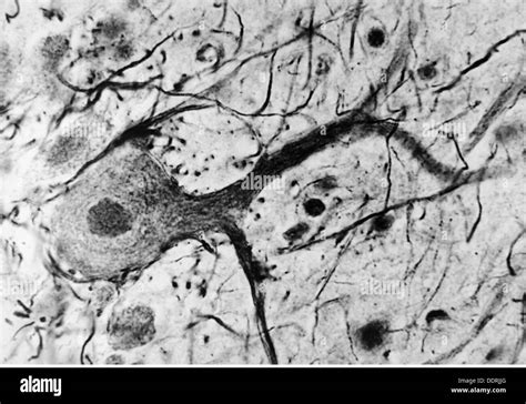 Médecine anatomie cerebrac cranium cellule nerveuse du cervelet