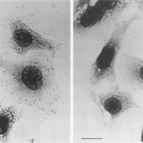 Adherence Pattern Of Haemophilus Strains With HeLa Cells By Light