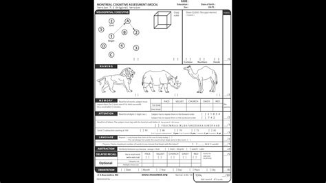 Montreal Cognitive Assessment Pdf Spanish Terica Mcgehee