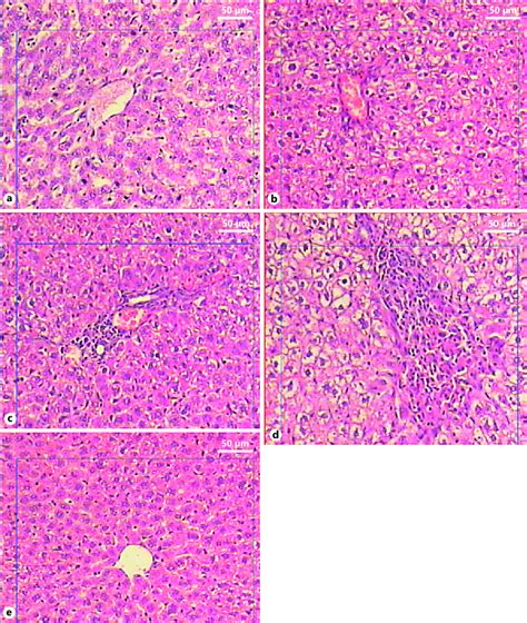 Photomicrograph Of Liver Sections Stained With Hematoxylin And Eosin Download Scientific