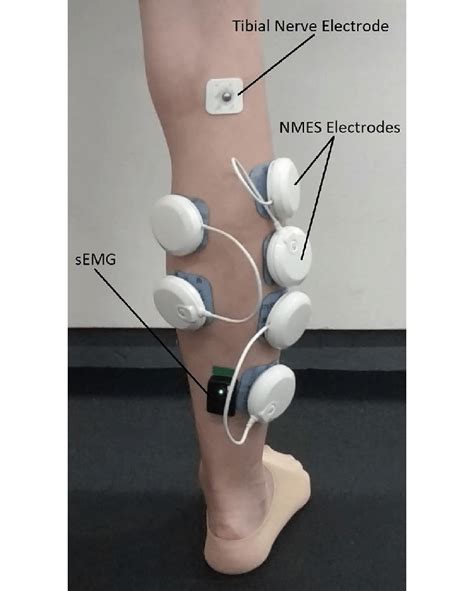 Electrodes Recording And Stimulating Positioning White Pods Download Scientific Diagram