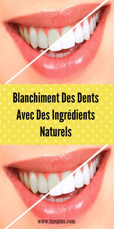 Le moyen le plus simple de blanchir les dents et déliminer les taches