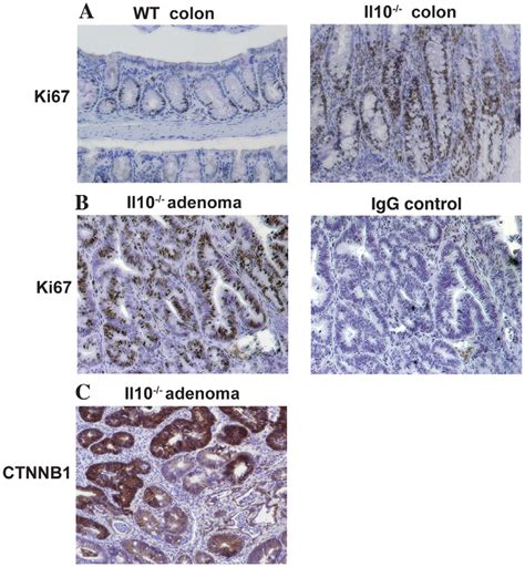 Il10 22 Normal Colon And Adenomas Exhibit Increased Cell Download